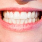 Aktualna technika wykorzystywana w salonach stomatologii estetycznej być może spowodować, że odbierzemy śliczny uśmiech.